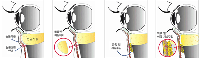 관련이미지