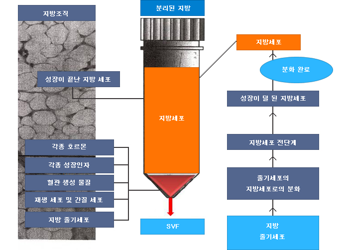 관련이미지