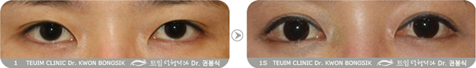 관련이미지